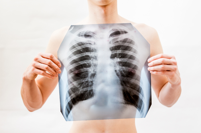 11 Dangerous Symptoms of Lung Cancer and How to Diagnose It